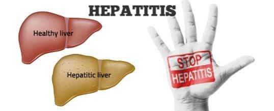 Hepatitis 538x218