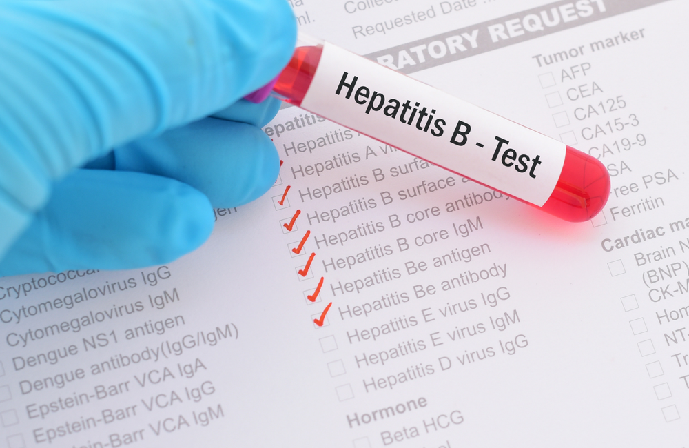 Hepatitis b 1