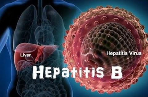 Hepatitis b