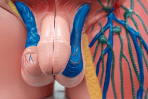 Hydrocele anatomy 1